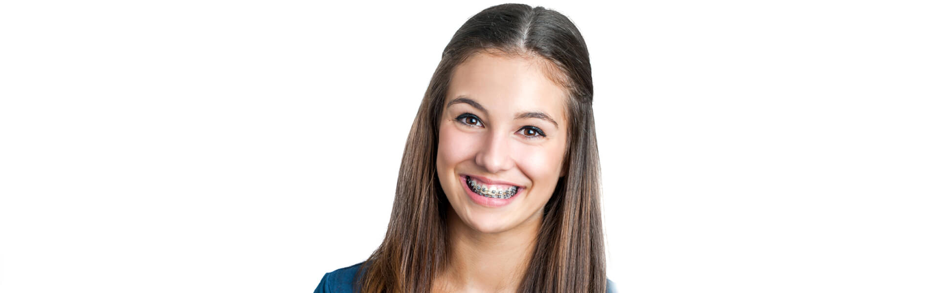 4 Types of Orthodontic Treatment That Can Straighten Your Smile