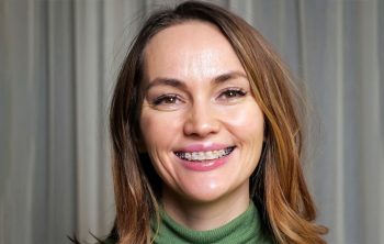 What Are Traditional Braces? How Does It Work?
